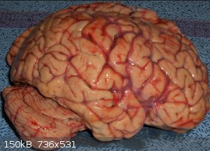brain.jpg - 150kB